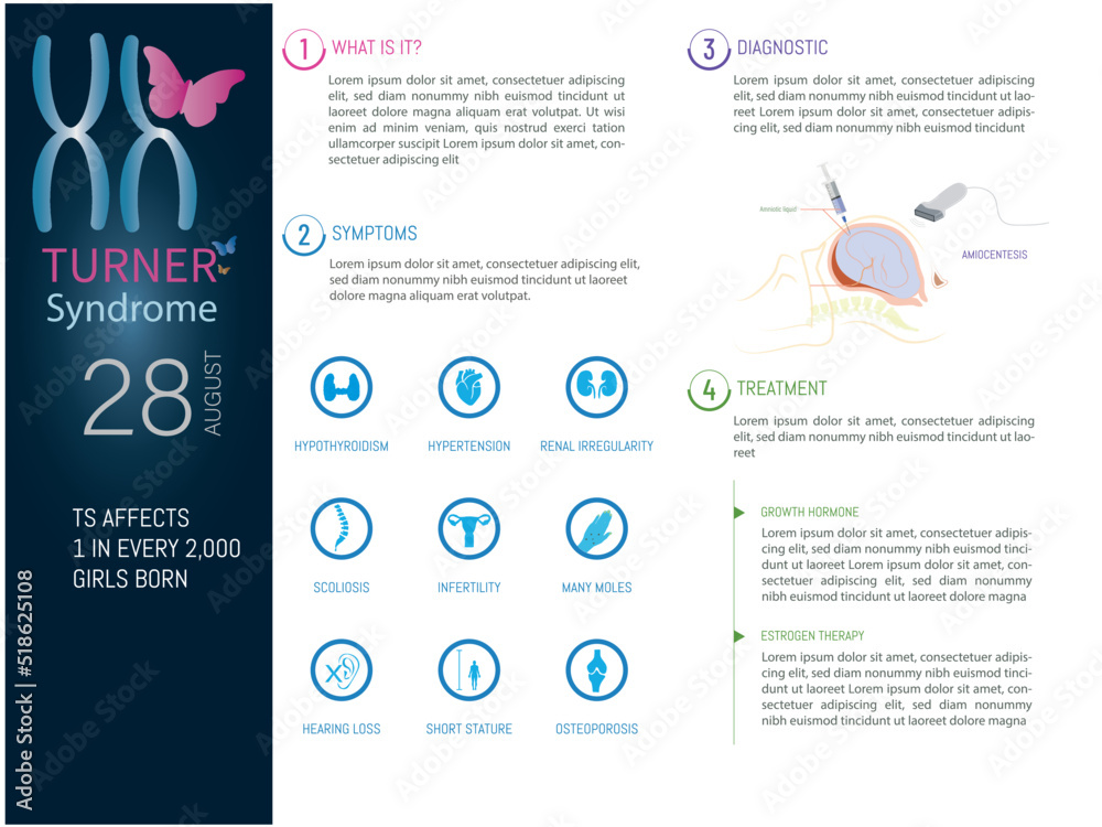 Obraz premium Infographic of Turner Syndrome, icons of the most typical symptoms, how it is diagnosed during pregnancy and possible treatments.