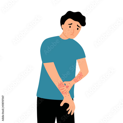Young man scratching hand and arm. Guy suffering from strong allergy skin itchy symptom in flat design. Red rash skin irritation.