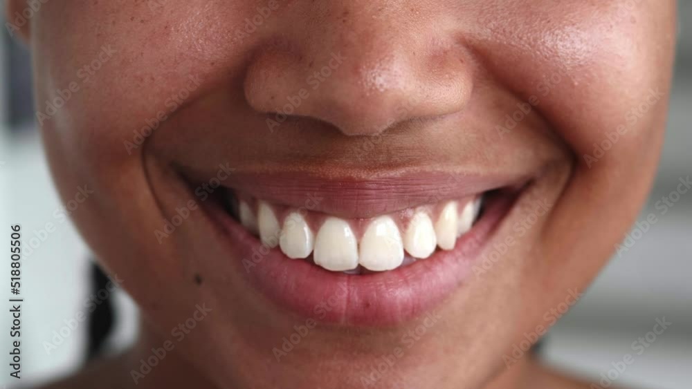 Close-up of glossy lips of a natural beauty woman with fresh and glowing skin, spreading ito a beautiful white and healthy toothy smile at camera. Beautiful diverse people, femininity, human face, Close-up of glossy lips of a natural beauty woman with fresh and glowing skin, spreading ito a beautiful white and healthy toothy smile at camera. Beautiful diverse people, femininity, human face,
