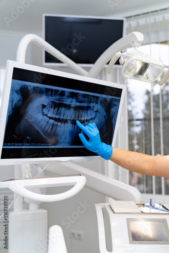 Obraz na plátne Teeth professional examining x ray