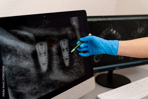 Teeth x ray professional examination. Monitor of dental healthcare.