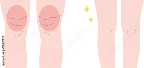 足が太い女性と細い女性のイラスト素材