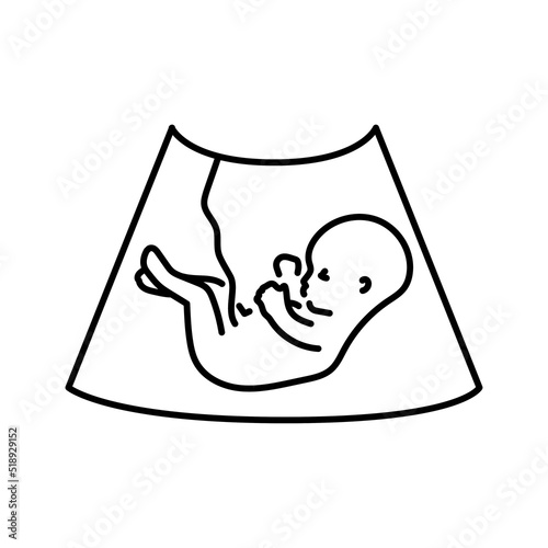 Ultrasound embryo color line illustration