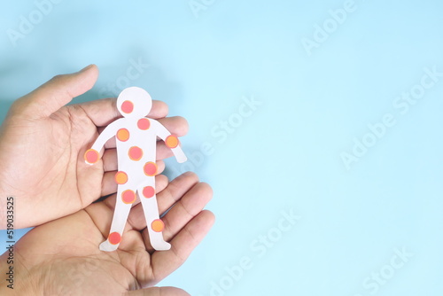 Pox disease such as monkeypox, smallpox and chicken pox care, prevention and protection concept. Hand holding human body cutout with red rash sores and blisters on skin in dark black background. photo