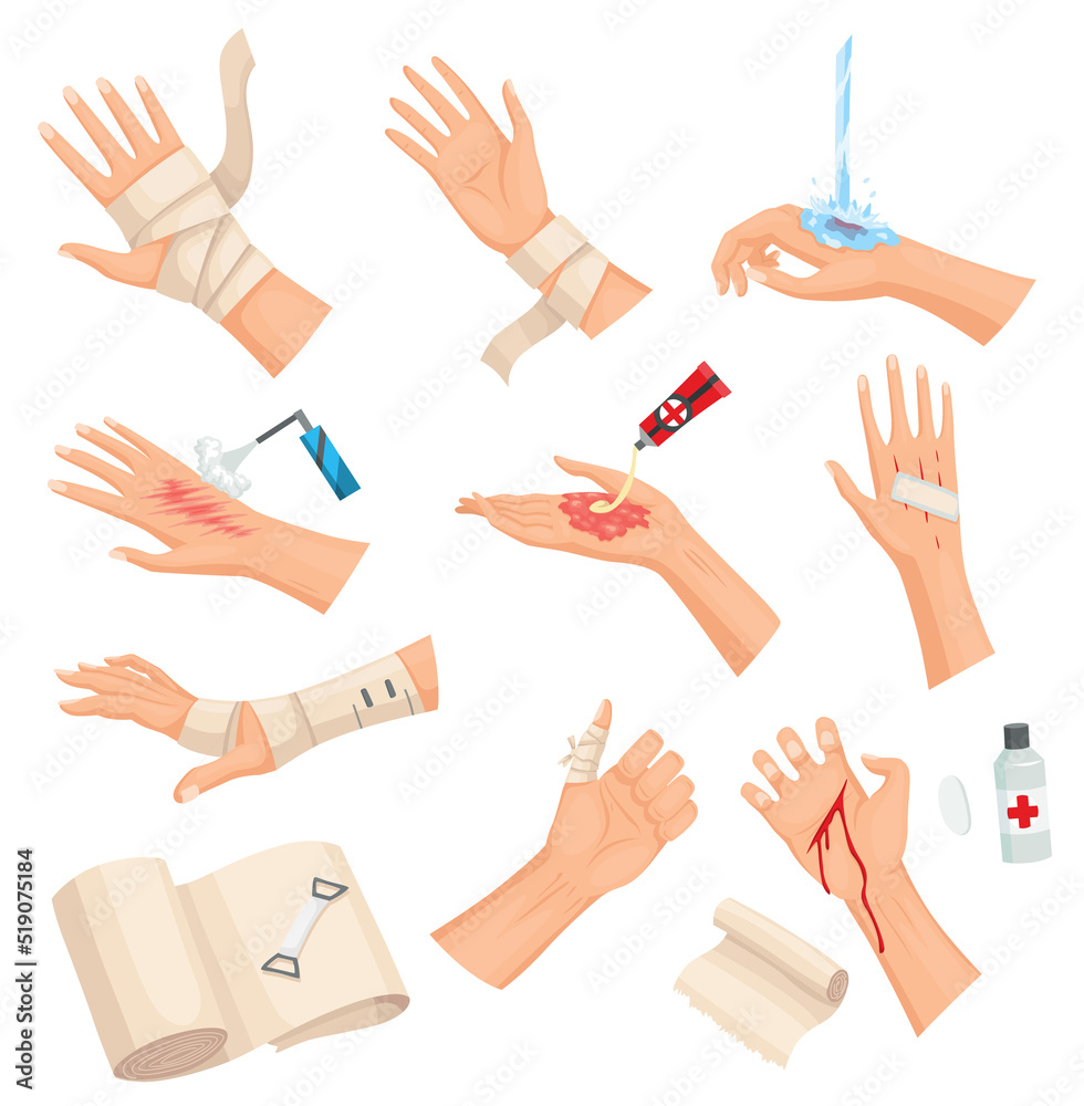 Hands injured skin and procedures of bandaging and wound cleaning. First aid for wound. Medicine cure or treatment. First emergency help for human hand trauma