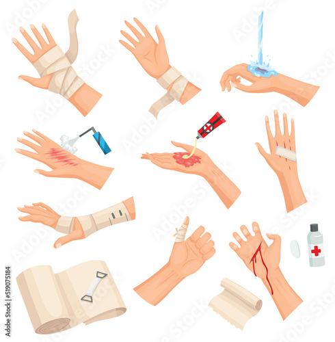 Obraz na płótnie Hands injured skin and procedures of bandaging and wound cleaning. First aid for wound. Medicine cure or treatment. First emergency help for human hand trauma w salonie