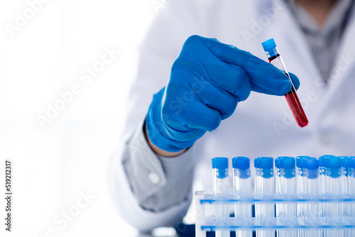 Lab assistant, a medical scientist, a chemistry researcher holds a glass tube through the blood sample, does a chemical experiment and examines a patient's blood sample. Medicine and research concept.