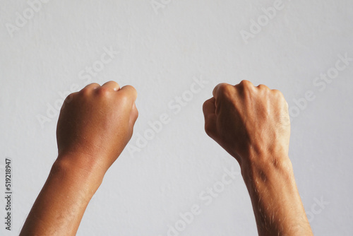 Fotografie, Obraz One male hand fist swollen. Close-up.