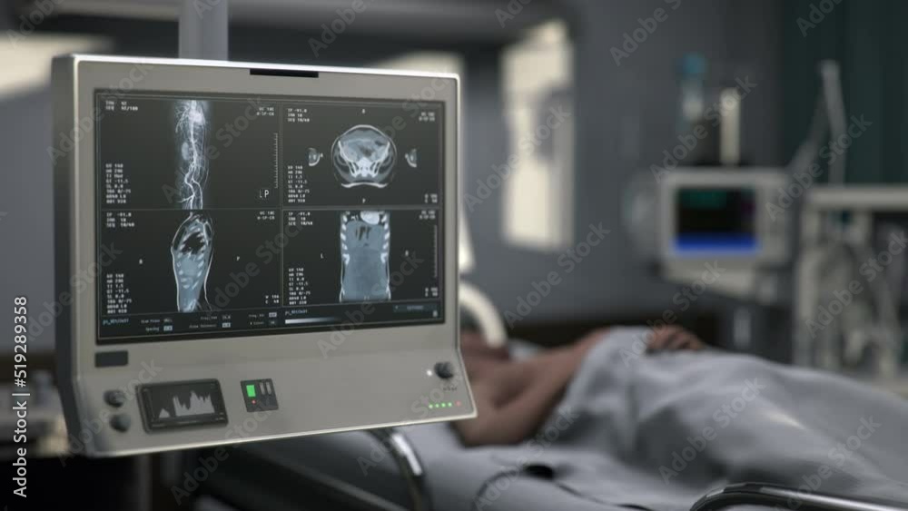 Medical Exam Of Patient Organs By Scanner In Emergency Hospital
