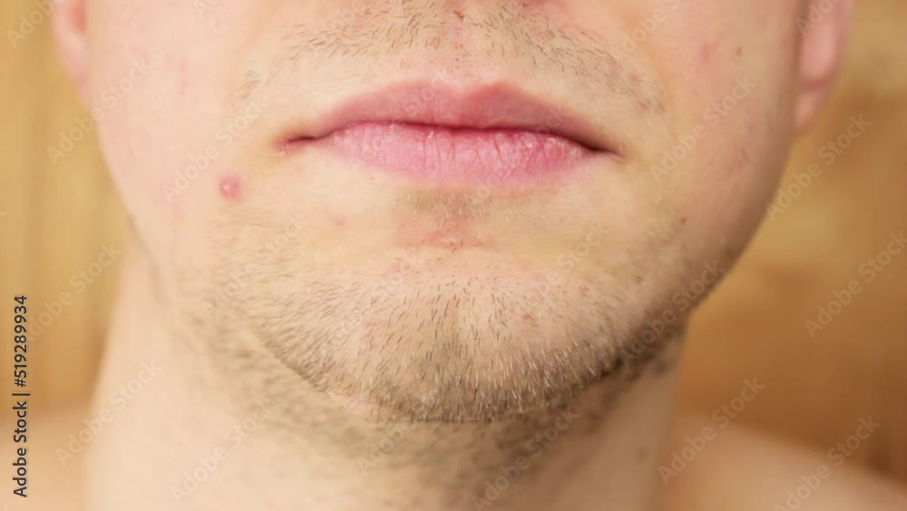 Man with scotch tape glued his lips.Concept threats, silence, hiding the truth. Man with scotch tape glued his lips.Concept threats, silence, hiding the truth.