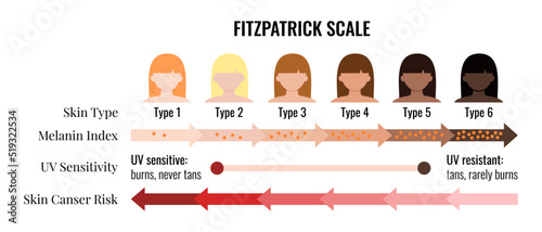 Fitzpatrick skin tone scale phototype melanin index with female avatar. Chart element with type I II III IV V IV human skin hair color melanin content in the cell cancer risk flat vector illustration © Irina