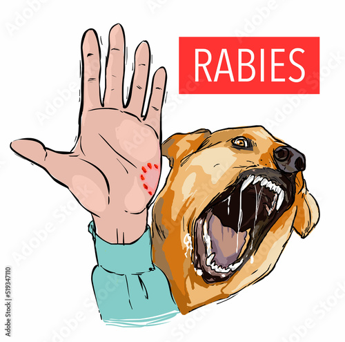 Dog bite, sick animal, the rabies virus  photo