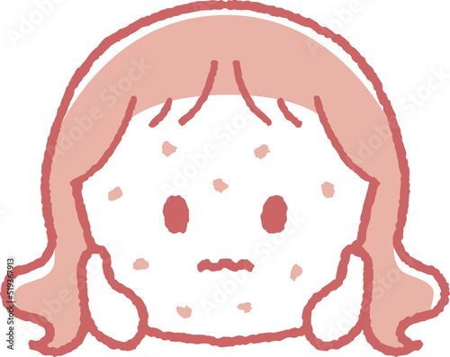 湿疹が出た女の子のイラスト