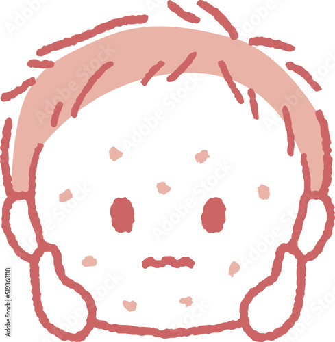 発疹が出ている男の子のイラスト