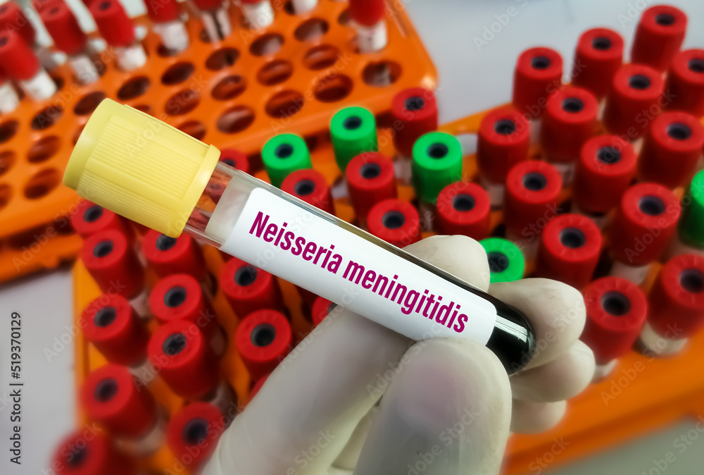 Blood sample for Neisseria meningitidis test, to diagnose Meningococcal