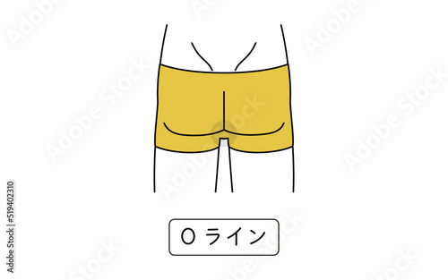 メンズ脱毛、Oライン、下着着用