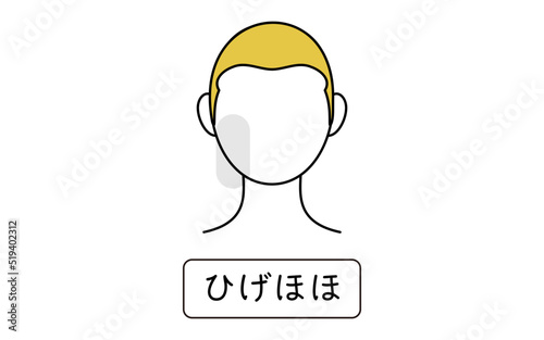 メンズ脱毛、ひげ脱毛、頬