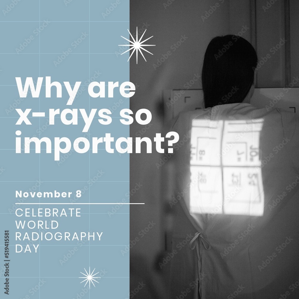 Light falling on woman back and why are xrays so important and