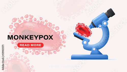 Monkeypox on microscope. Monkeypox virus outbreak concept, monkeypox cells. Vector illustration in 3D realistic style