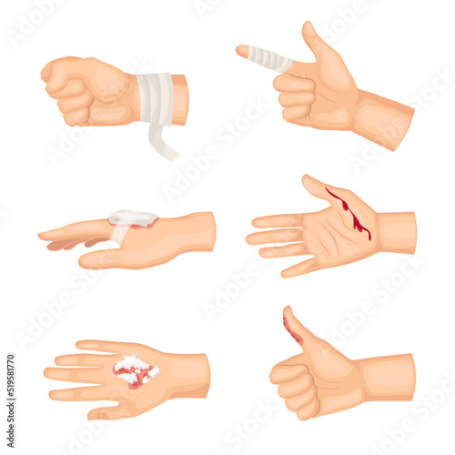 Hands with different types of wounds cartoon illustration set. Bandaged arm, cut and burn on human hand and hand with plaster. Wound, healthcare, hospital, first aid concept