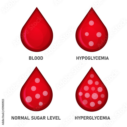 Glucose Blood Sugar Level Set. Hypoglycemia and Hyperglycemia Icons. Vector