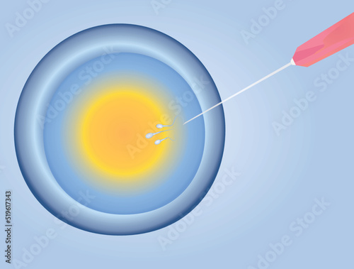 IVF insemination fertility. vector illustration