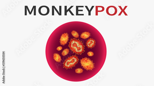Monkeypox virus cells. Monkeypox virus outbreak pandemic design with microscopic view background. Virus epidemic outbreak. Health care in USA, Europe and Asia. Vector EPS10 Illustration.