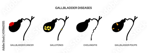 Gallbladder diseases poster