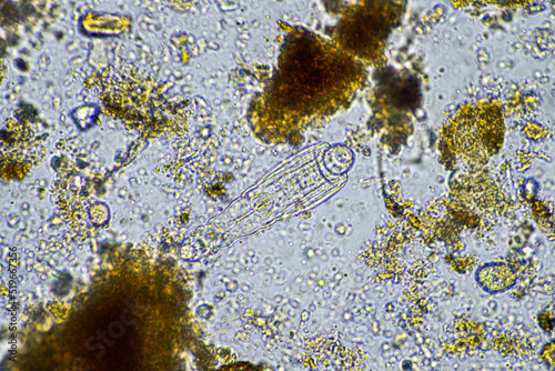 soil microbes organisms in a soil and compost sample, testate amoebae under the microscope in regenerative agriculture. in australia. photo