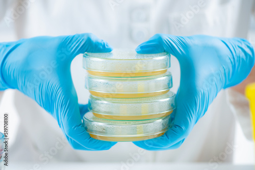 Microbiology. Hands of a microbiology lab technician holding a stack with Petri dishes containing bacterial cultures spread over nutritional agar.
