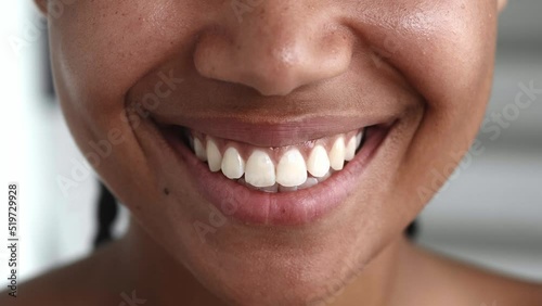 Soft focus on the glossy lips of a charming young woman spreading into a beautiful toothy smile. Health care, dentistry, body care concept. Partial view of a woman face photo