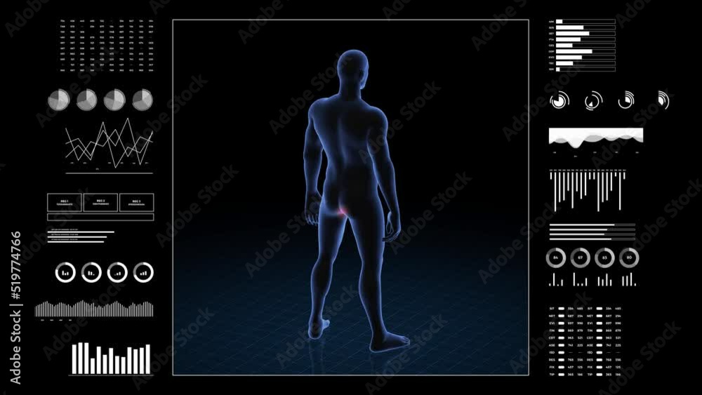 Man with anus pathology. 3d body of boy. Rotating animation and closeup of male human structure. Stock ビデオ | Adobe Stock