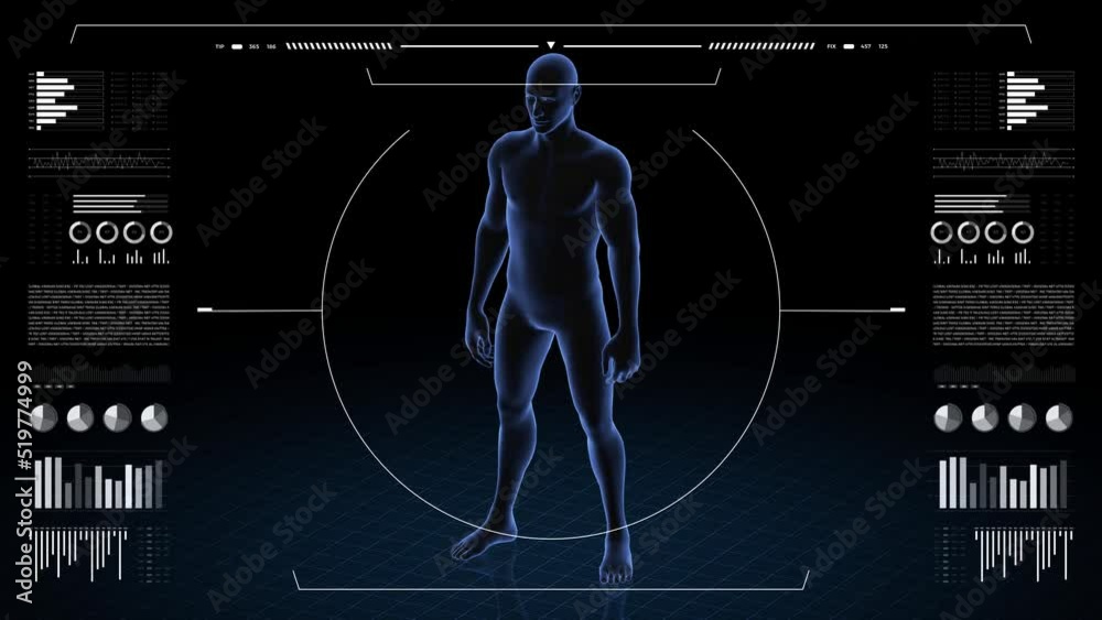 Man with pathology. 3d body of boy. Male human figure. Man with pathology. 3d body of boy. Male human figure.