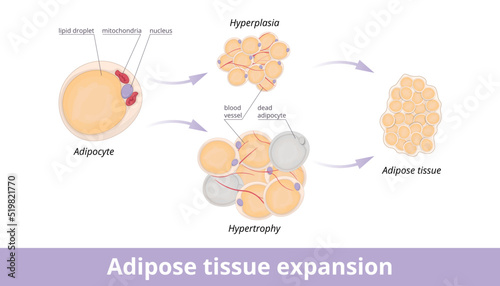 Adipose tissue expansion. Mechanisms of adipose tissue expansion: hypertrophic and hyperplasic adipose. Hypertrophic and hyperplasic fat cells in fat tissue. photo