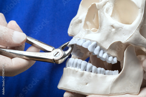 Wallpaper Mural Treatment of toothache. A dentist holds a plastic human skull and teaches how to extract teeth. Torontodigital.ca