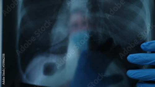 Close-up lungs X-ray image with blurred unrecognizable doctor at background pointing at test result. Caucasian professional radiologist examining roentgen in hospital. Roentgenology concept photo