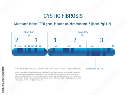  Fibrosis Quistica.Las mutaciones en el gen CFTR, situado en el cromosoma 7