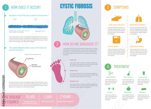 Infographic about cystic fibrosis disease, what is its origin, symptoms, diagnosis, treatments.