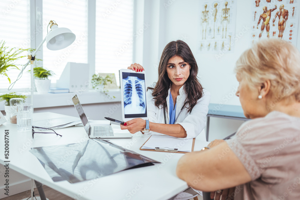 Lung cancer concept. Doctor explaining results of lung check up from x