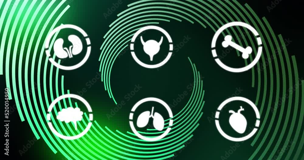 Animation of human body icons over green background with lines Animation of human body icons over green background with lines