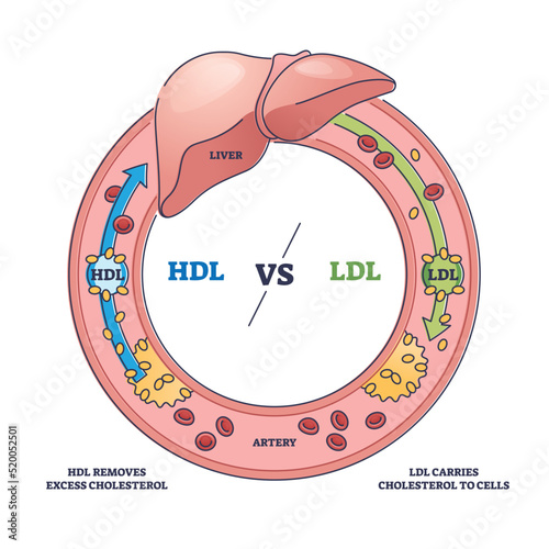Good HDL and bad LDL cholesterol movement comparison outline diagram. Labeled educational scheme with liver function and fat cells flow to cells vector illustration. Artery disease risk explanation.