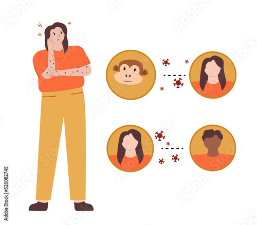 Vector illustration of the spread of the monkey pox virus from monkey to human and from human to human in a flat style. A girl with smallpox of a monkey with a red rash and headache.