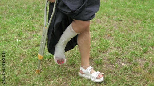 A young girl with a cast walks around the park on crutches on the lawn on a bright sunny day.Rehabilitation after a leg sprain fracture in the fresh air.Walking with crutches outside the hospital.