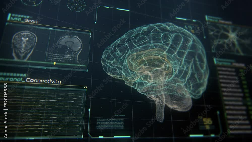 MRI Scan Interface with Human Brain, Neurons and Data. MRI Scan Interface with Human Brain, Neurons and Data.