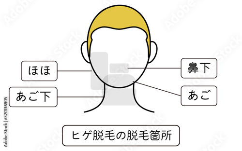 ヒゲ脱毛の脱毛箇所の図解