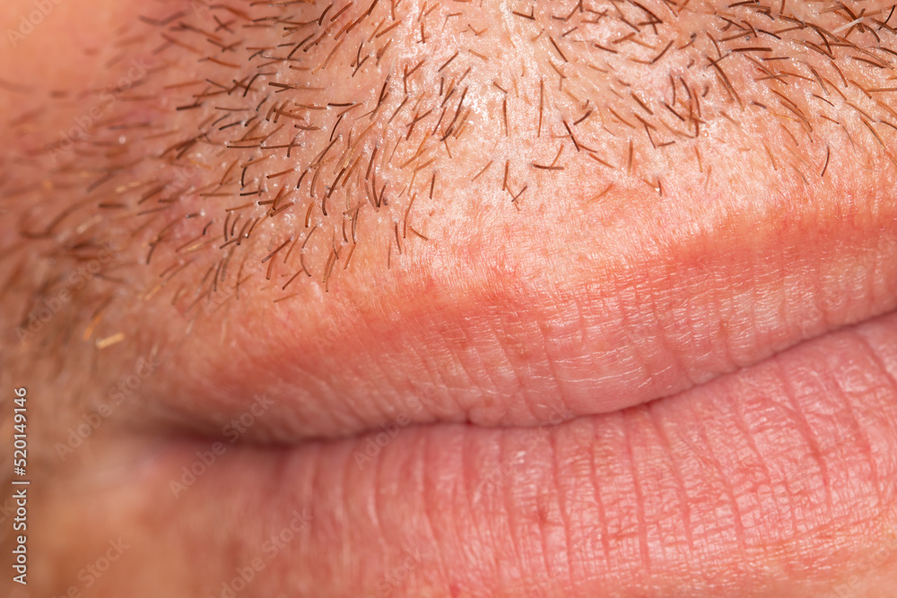 Fototapeta premium Hair on the skin of a man's face. Macro