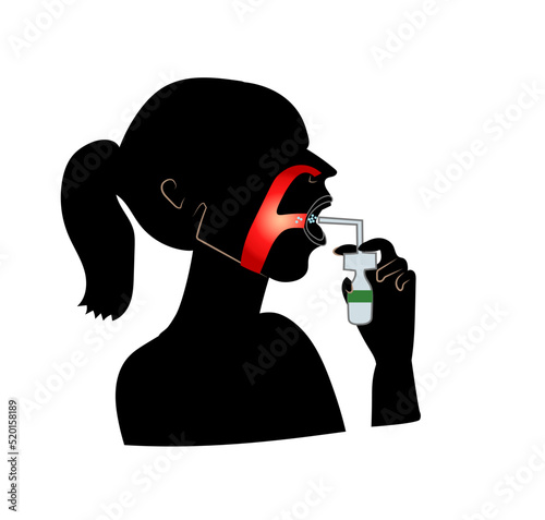Sore throat, spray for throat, medical vector illustration