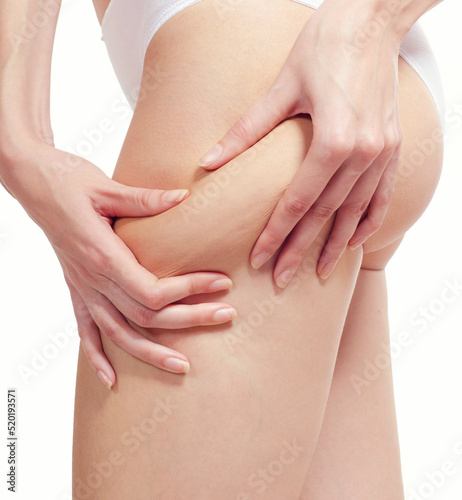 Cellulite skin on woman buttocks