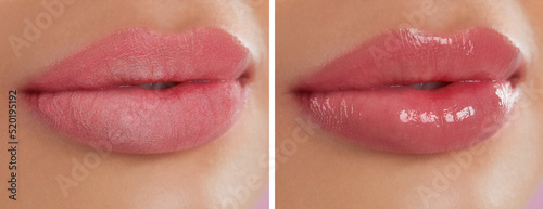 Collage with photos of woman with dry and moisturized lips, closeup. Banner design photo