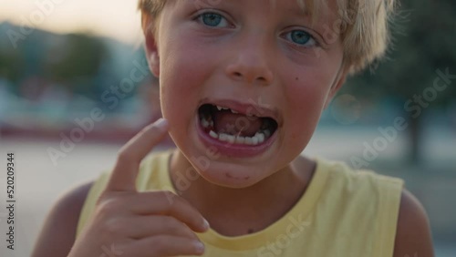  a small boy with blond hair with showing his milk tooth opening his mouth to show where he lost one of his baby's milk tooth while eating ice cream. High quality 4k footage